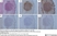 Anti Human Macrophages Antibody, clone MAC387 thumbnail image 13