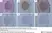 Anti Human Macrophages Antibody, clone MAC387 thumbnail image 13