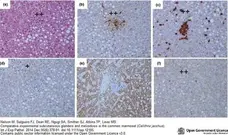 Anti Human Macrophages Antibody, clone MAC387 gallery image 14