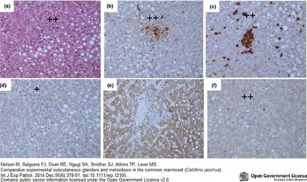Anti Human Macrophages Antibody, clone MAC387 gallery image 14