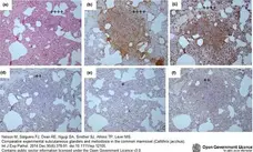 Anti Human Macrophages Antibody, clone MAC387 gallery image 15