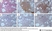 Anti Human Macrophages Antibody, clone MAC387 thumbnail image 15