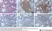 Anti Human Macrophages Antibody, clone MAC387 thumbnail image 15