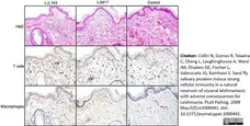 Anti Human Macrophages Antibody, clone MAC387 gallery image 17