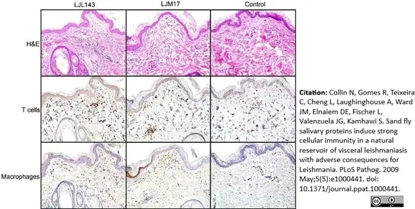 Anti Human Macrophages Antibody, clone MAC387 gallery image 17