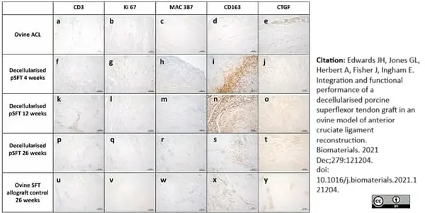 Anti Human Macrophages Antibody, clone MAC387 gallery image 18