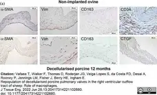 Anti Human Macrophages Antibody, clone MAC387 gallery image 19