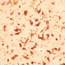 Anti Human Macrophages Antibody, clone MAC387 gallery image 2