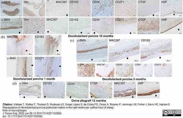 Anti Human Macrophages Antibody, clone MAC387 gallery image 20
