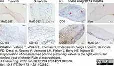 Anti Human Macrophages Antibody, clone MAC387 gallery image 21