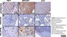 Anti Human Macrophages Antibody, clone MAC387 gallery image 23