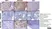 Anti Human Macrophages Antibody, clone MAC387 thumbnail image 23