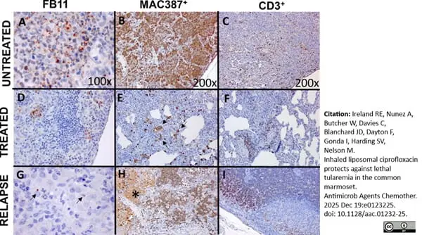 Anti Human Macrophages Antibody, clone MAC387 gallery image 23