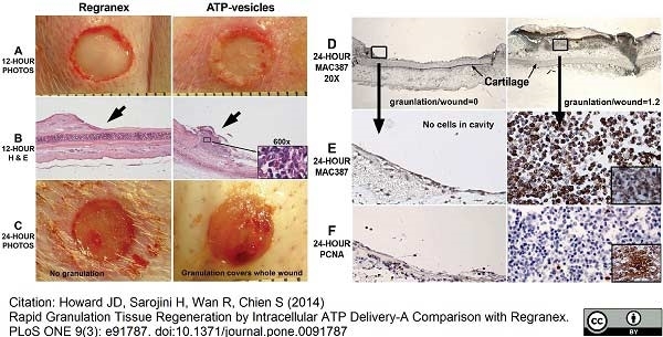 Anti Human Macrophages Antibody, clone MAC387 gallery image 9