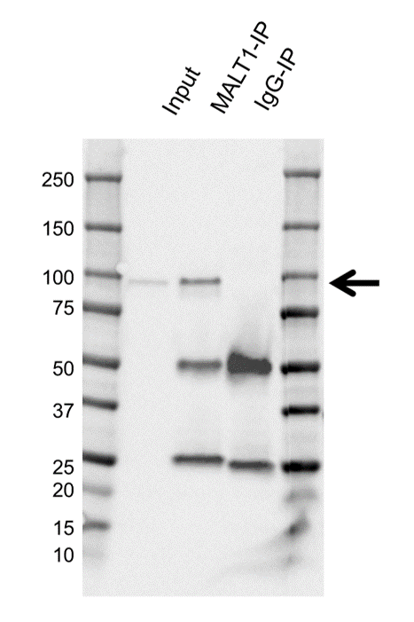 Anti MALT1 Antibody, clone 50 (PrecisionAb Monoclonal Antibody) gallery image 5