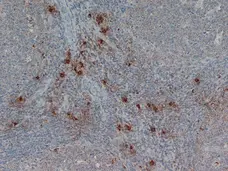 Anti Human Mast Cell Tryptase Antibody, clone AA1 gallery image 1