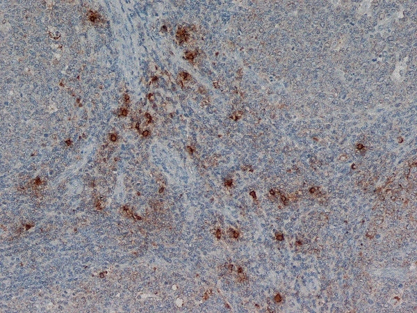 Anti Human Mast Cell Tryptase Antibody, clone AA1 gallery image 1