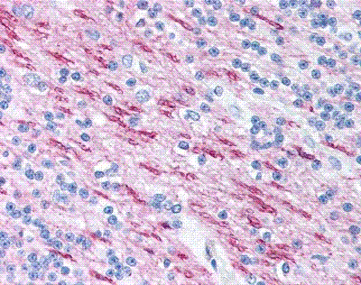 Anti Human MBP (aa84-89) Antibody, clone 22 gallery image 1