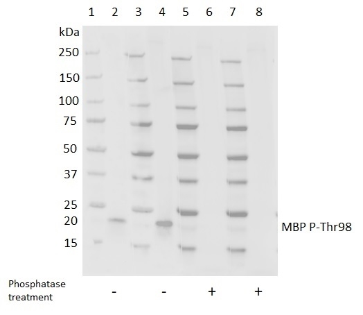Anti MBP (pThr98) Antibody, clone 98P/12 gallery image 1