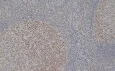 Anti Human MCM2 Antibody, clone CRCT2.1 gallery image 4