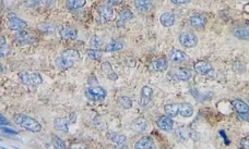 Anti Human MCP-1 Antibody, clone 2.2-4H5-1A11 gallery image 1