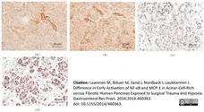 Anti Human MCP-1 Antibody, clone 2.2-4H5-1A11 gallery image 4