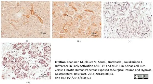 Anti Human MCP-1 Antibody, clone 2.2-4H5-1A11 gallery image 4