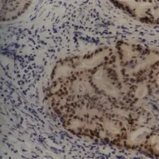 Anti MDM2 Antibody, clone SMP14 gallery image 1