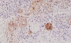 Anti MELAN-A Antibody, clone RM333 gallery image 1