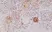 Anti MELAN-A Antibody, clone RM333 thumbnail image 1