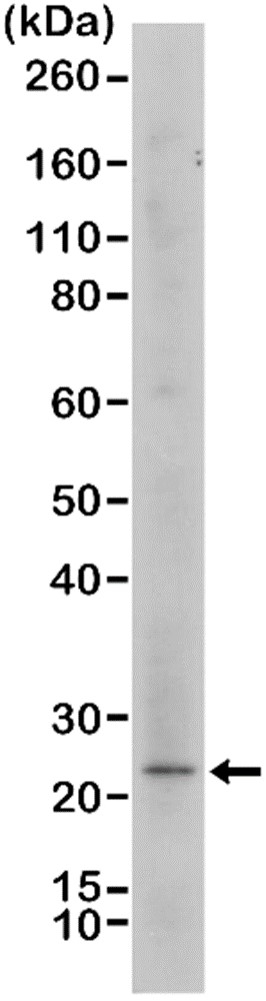 Anti MELAN-A Antibody, clone RM333 gallery image 2