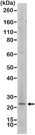 Anti MELAN-A Antibody, clone RM333 thumbnail image 2