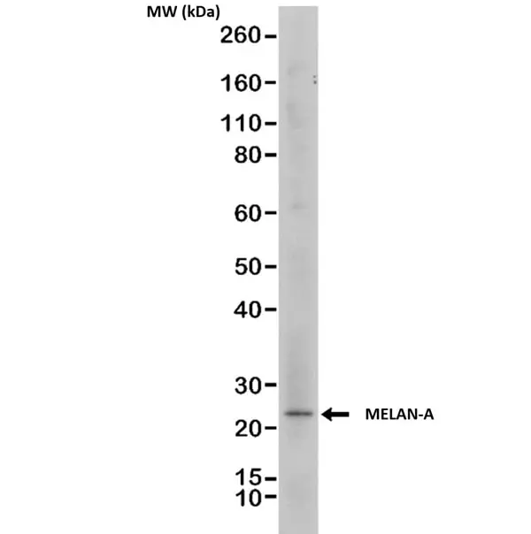 Anti MELAN-A Antibody, clone RM333 gallery image 2