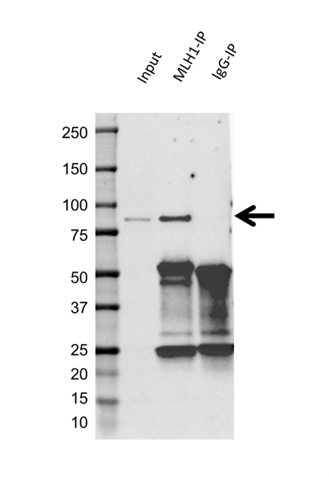 Anti MLH1 Antibody, clone UMAB191 (PrecisionAb Monoclonal Antibody) gallery image 2