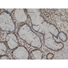 Anti Human MMP-1 Antibody, clone 3B6 gallery image 1