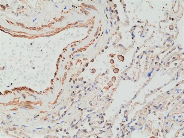 Anti MMP-12 Antibody, clone RM381 gallery image 2