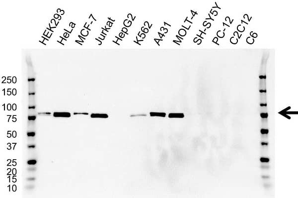 Anti MMP-2 Antibody (PrecisionAb Monoclonal Antibody) gallery image 1