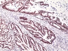 Anti MSH3 Antibody, clone RM405 gallery image 2