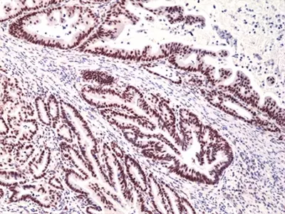 Anti MSH3 Antibody, clone RM405 gallery image 2