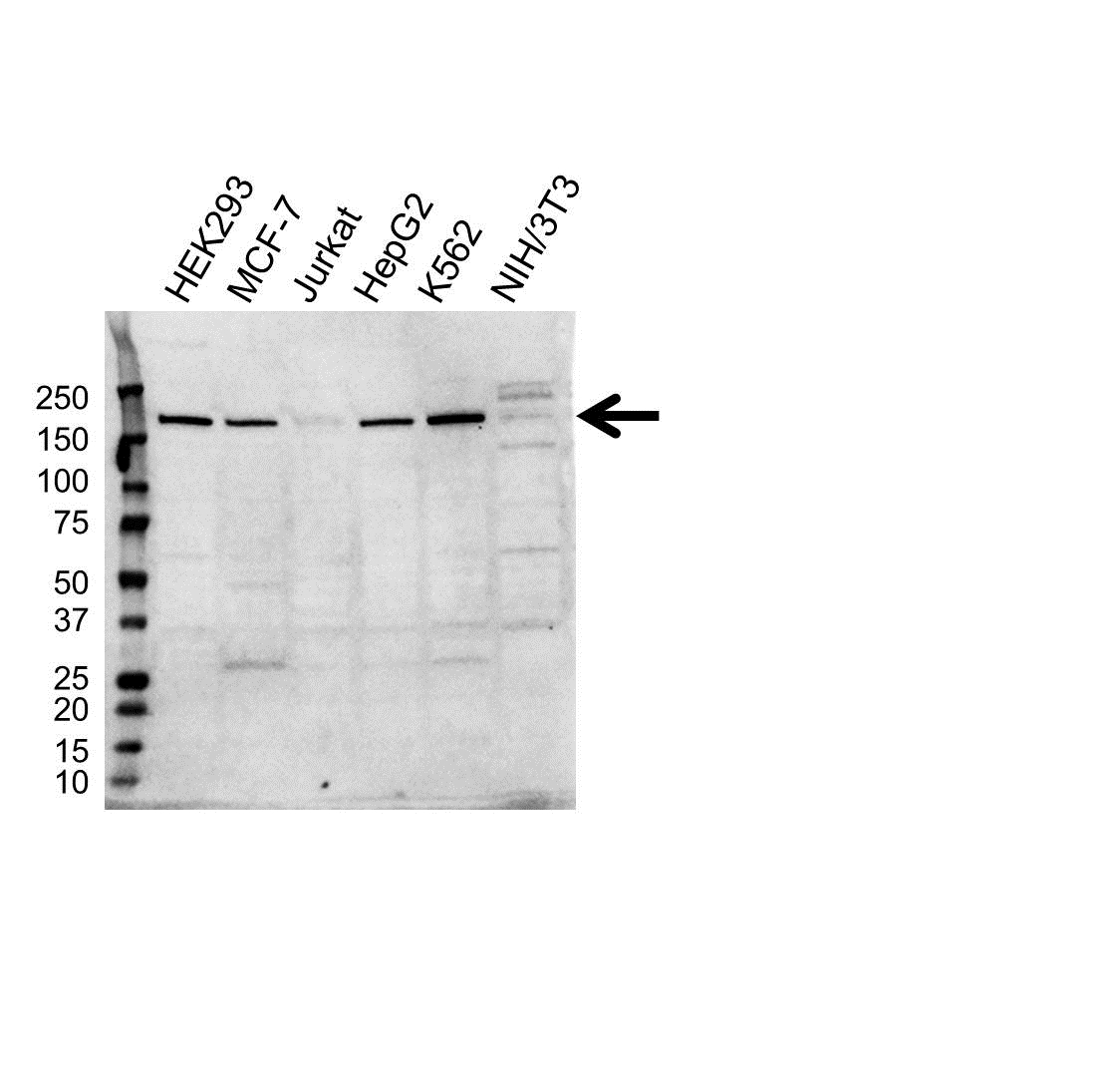 Anti MSH6 Antibody, clone 3E1 (PrecisionAb Monoclonal Antibody) gallery image 1