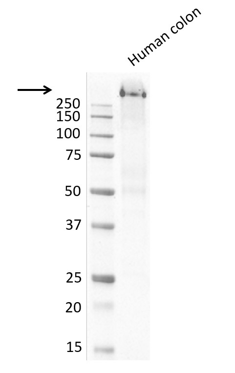 Anti MUCIN 1 Antibody, clone MUC1/520 (PrecisionAb Monoclonal Antibody) gallery image 4
