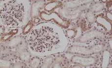 Anti MyD88 Antibody, clone RM306 gallery image 2