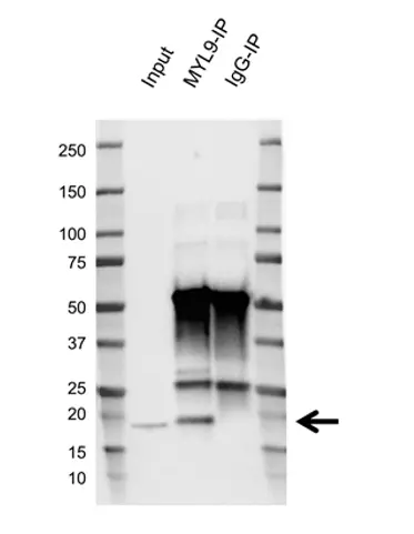 Anti Myosin Regulatory Light Chain Antibody, clone AB03/2F2 (PrecisionAb Monoclonal Antibody) gallery image 2