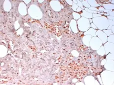 Anti Human N-Cadherin Antibody, clone 13A9 (Monoclonal Antibody Antibody) gallery image 1