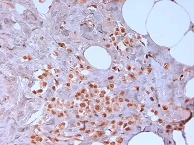 Anti Human N-Cadherin Antibody, clone 13A9 (Monoclonal Antibody Antibody) gallery image 2