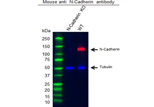 Anti Human N-Cadherin Antibody, clone 13A9 (Monoclonal Antibody Antibody) gallery image 4