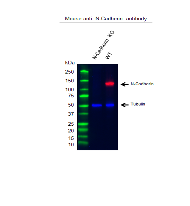Anti Human N-Cadherin Antibody, clone 13A9 (Monoclonal Antibody Antibody) gallery image 4