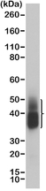 Anti NAPSIN-A Antibody, clone RM366 thumbnail image 1