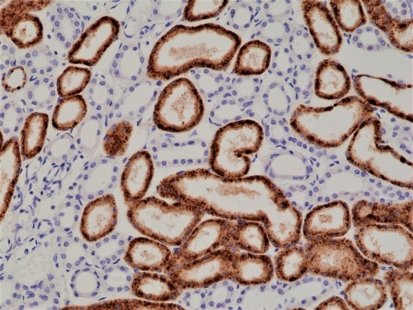 Anti NAPSIN-A Antibody, clone RM366 gallery image 2
