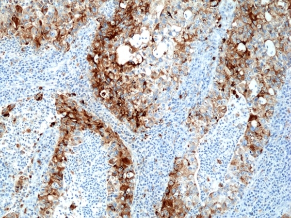 Anti NAPSIN-A Antibody, clone RM366 gallery image 3